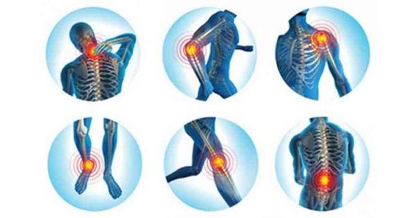 Physiotherapy Painful joints