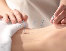 Fertility Acupuncture