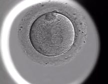 IVF Infertility